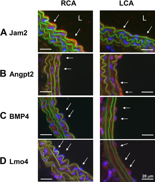 Figure 3. Disturbed flow in LCA decreases protein expression of Jam2 while up-regulating Angpt2, BMP4, and Lmo4. C57BL/6 mice underwent partial ligation, and LCA and RCA were collected 2 days after ligation. Paraffin sections were stained with specific antibodies for Jam2 (A), Angpt2 (B), BMP4 (C), and Lmo4 (D). Nuclei were counterstained with Hoechst (blue). Arrows indicate the protein expression in endothelial cells. L indicates lumen. Images are representative of n = 4 mice.