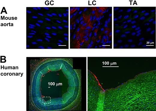 Figure 4. Lmo4 is differentially expressed in mouse aortic arch and human coronary artery. (A) En face staining of greater curvature (GC), lesser curvature (LC) of the arch, and the thoracic aorta (TA) was performed with Lmo4 antibody (red). Blue signal indicates nuclei stained with 4,6-diamidino-2-phenylindole; green signal indicates elastic laminae detected by autofluorescence. Shown are representative images of 7 different mice. (B) Paraffin sections of human left anterior descending coronary artery were stained for Lmo4 protein expression. Overall staining patterns were shown at low magnification (original magnification ×5) as a composite figure and zoomed views (original magnification ×20) of the indicated areas (broken box). The raw images of the composite figure are shown in supplemental Figure 3.