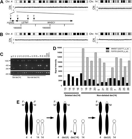 Figure 4. Loss of expression of FGFR3 in t(4;14) myeloma is a result of loss of der(14). (A) A copy number plot output from CNAG showing an example of a t(4;14) sample without expression of FGFR3 with decreased copy number at 4p16-ptel on chromosome 4 and on chromosome 14. The enlarged area shows the approximate positions of the breakpoints in the 4 samples without FGFR3 expression (down arrows). (B) As above but for a t(4;14) sample with FGFR3 over-expression. (C top panel) IgH-MMSET cDNA products from each t(4;14) sample, with or without loss of der(14), and controls H929 (t(4;14) positive) and MM1s (t(4;14) negative). Bands at 1000, 400 and 200 bp correspond to MB4-1, MB4-2 and MB4-3 breakpoint products. (Bottom panel) ABL control cDNA PCR. (D) Expression levels of FGFR3 and MMSET in the t(4;14) samples by microarray. (E) A model explaining the loss of FGFR3 expression in a sample with a t(4;14) translocation through deletion of der(14) chromosome (see “Results” for details). F = FGFR3 locus, M = MMSET locus.