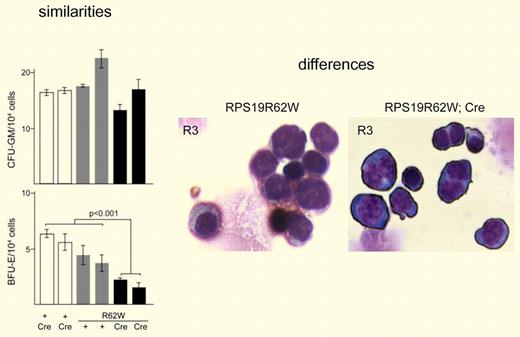 Data from Devlin et al8 that show both similarities and differences between hematologic parameters observed for RPS19R62W transgenic mice and DBA patients. Left panel: Similarities include granulocyte/macrophage precursors less affected than erythrocyte lineages. Right panel: Differences include binucleate erythroblasts not commonly found in circulation of DBA patients.
