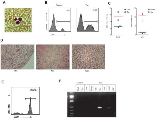 Figure 6. NSG mice adoptively transferred with LTR-Tax CD4+ T cells exhibit CD4+ T-cell proliferation. CD4+ T cells from LTR-Tax or littermate control mice were activated with anti-CD3 and anti-CD28 for 2 weeks in vitro and transferred into NSG mice. Recipient mice were euthanized at 2-4 months. (A) Geimsa staining of blood smear from a representative LTR-Tax CD4+ T cell–inoculated NSG mouse showing the presence of cells exhibiting lymphoblastoid phenotype adjacent to a neutrophil. Micrographs were obtained by visualization with a 40×/0.6 objective lens, using a Nikon EclipseTE2000-S microscope, Roper Scientific Photometrics imaging system, and Image Pro plus image acquisition software Version 4.5.0.29. (B) Flow cytometric analysis of blood leukocytes from NSG mice. 32.6% of cells in LTR-Tax CD4+ cell–inoculated NSG mouse (same as panel A) were CD4+;, compared with 10% in control cell inoculated mice. (C) Total CD4 + T-cell counts in the blood and spleen of control or LTR-Tax cell–inoculated NSG mice, calculated as the percentage of gated CD4+ cells multiplied by the total number of blood leukocytes or splenocytes. (D) Histologic analysis (H&E staining) of a representative lymph node from the LTR-Tax-injected NSG mice, demonstrating diffuse infiltration of lymphoid cells (using 10×/0.2, 40×/0.65, and 100×/1.25 objectives, on a Leica DME microscope, Nikon Coldpix4500 camera and Nikon View 5.0 software). No lymph nodes were detected in littermate control inoculated NSG mice. (E) Percentage of lymph node cells expressing CD4, as determined by flow cytometry (representative specimen). (F) Tax expression in adoptively transferred NSG mice. NSG mice treated with LTR-Tax CD4+ T cells are positive for Tax. PCR for Tax expression (∼ 1kb) was performed from DNA (∼ 1 ug) that was extracted from various tissue taken from NSG mice adoptively transferred with LTR-Tax or littermate control CD4+ T cells that were previously activated ex vivo and cultured for 2 weeks prior to transfer. As shown NSG mice treated with LTR-Tax CD4+ T cells are positive for Tax in spleen and lymph node derived DNA.