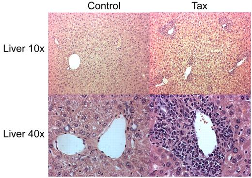 Figure 7. Parenchymal lymphocytic infiltration in liver of LTR-Tax CD4+ T cell–recipient NSG mice. Histology of liver sections from NSG mice inoculated with LTR-Tax or control CD4+ T cells were analyzed by H&E staining (10-40× magnification). Micrographs were obtained using 10×/0.3 and 40×/0.6 objectives, as indicated, a Nikon EclipseTE2000-S microscope, Roper Scientific Photometrics imaging system, and Image Pro plus image acquisition software Version 4.5.0.29.