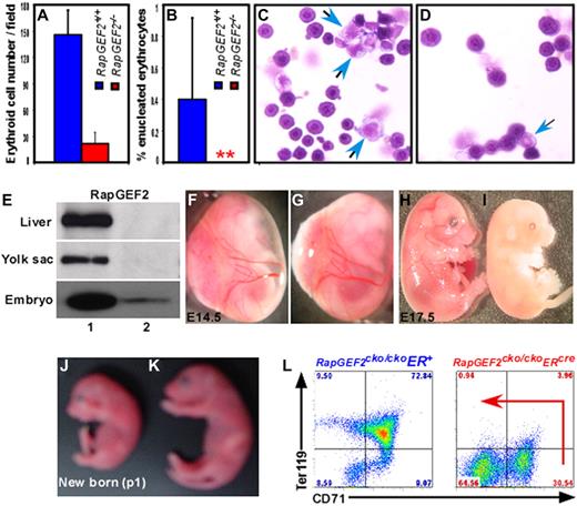 Figure 5. Defective fetal liver hematopoiesis in RapGEF2−/− mice. (A-B) Histogram showing the average number of nucleated (A) and enucleated (B) erythroid cells in the peripheral blood of E10.5 RapGEF2+/+ and RapGEF2−/− embryos. (C) Representative photographs displaying the cytospined and stained peripheral blood of E10.5 RapGEF2+/+ (C) and RapGEF2−/− (D) embryos. Blue arrows indicate myeloid progenitors whereas remaining cells are nucleated erythroid cells. (E) Northern blot showing the expression level of RapGEF2 in the E16.5 liver, yolk sac, and embryo of RapGEF2cko/ckoER+ (lane 1) and RapGEF2cko/ckoERcre (lane 2) mice. Females were injected with tamoxifen on day 11.5 and 13.5 of pregnancy. (F-G) Photographs showing the yolk sac blood vessels of E14.5 RapGEF2cko/ckoER+ (F) and RapGEF2cko/ckoERcre (G) embryos. (H-I) Photographs of E17.5 RapGEF2cko/ckoER+ (H) and RapGEF2cko/ckoERcre (I) embryos. The embryos were analyzed under Stemi SV11, Zeiss binocular microscope and photographed by Sony DSC-S85 digital camera. The E17.5 RapGEF2cko/ckoERcre embryos were pale, soft, fragile, and devoid of blood vessels. Timed matings were set up between the RapGEF2cko/+ERcre heterozygotes, and the pregnant females were given tamoxifen by injection to induce RapGEF2 deletion. First dose of tamoxifen was injected at E11.5, when yolk sac vascularization is mostly complete. Second dose was give at E13.5. If the induced deletion of RapGEF2 at this stage leads to embryonic lethality, we could conclude that the lethality in RapGEF2cko/ckoERcre mice was not due to yolk sac vascular defects. (J-K) Day-1 RapGEF2cko/ckoERcre (J) and RapGEF2cko/ckoER+ (K) neonates. Pregnant females were given tamoxifen by injection on days 17.5 and 19.5 of pregnancy. (L) Representative FACS images showing the distribution of the CD71+Ter119+ population in the E16.5 fetal liver cells of RapGEF2cko/ckoER+ and RapGEF2cko/ckoERcre embryos.