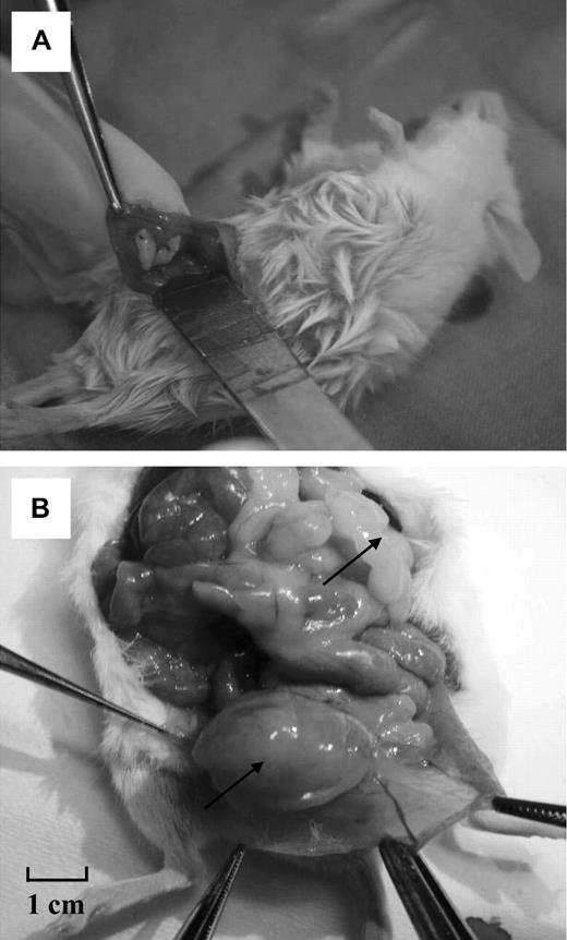 Figure 1. Macroscopic view of the surgical procedure and a diseased mouse after long-term grafting (external and internal views). (A) Two human ovarian fragments from a patient with leukemia are grafted intraperitoneally to a female SCID mouse. (B) The same mouse after death. Multiple large, hard masses were found in the abdomen. One is shown in a parasplenic location and another developing from the ovarian graft.