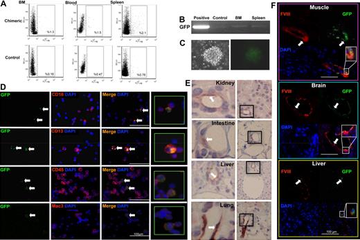Figure 4. BM reconstitution with uterine GFP+ blast: 12-month follow-up in vivo. Representative scatter plots illustrating percentages of GFP+ cells in the BM, blood, or spleen of the chimeric recipients (A; by FACS; N = 5). RT-PCR confirmed GFP mRNA expression in the chimeric BM and spleen (B). Control indicates wild-type BMCs (negative control); and positive, GFP+ transgenic BMCs (positive control). Recipient BMCs were cultured in MethoCult media. GFP+ colony-forming units were observed at day 7 (C). Representative micrographs illustrating coexpression of GFP and hematopoietic markers (CD16, CD13, CD45, and Mac-3) in BM isolates from the recipients (D, white arrows). DAPI indicates nuclear stain. Representative micrographs illustrating GFP expression (areas indicated in black boxes at right are enlarged at left, original magnification ×400) in formaldehyde-fixed tissue sections from multiple organs in the recipients (E, white arrows). Representative micrographs illustrating factor VIII and GFP expression (white arrows; colocalization and enlargement shown at bottom right) in the vasculature of frozen tissue sections from recipient somatic tissues (F).