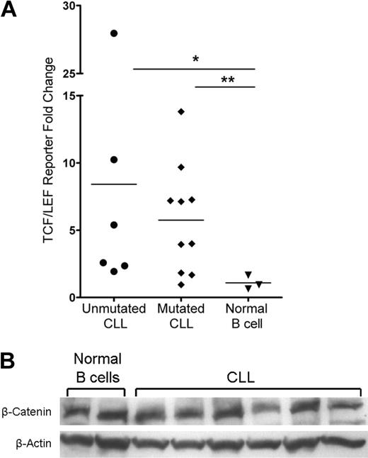 Figure 3. Activation of the Wnt pathway in CLL cells and not in normal mature B cells. (A) TCF/LEF dual luciferase reporter assay relative fold change of positive reporter samples from 6 unmutated CLL samples, 10 mutated CLL samples, and 3 normal B-cell samples. *P = .024. **P = .014. Horizontal lines indicate the mean of the group. (B) Western blot analysis of β-catenin in 6 CLL and 2 normal B-cell samples. β-Actin shown as a loading control of samples.