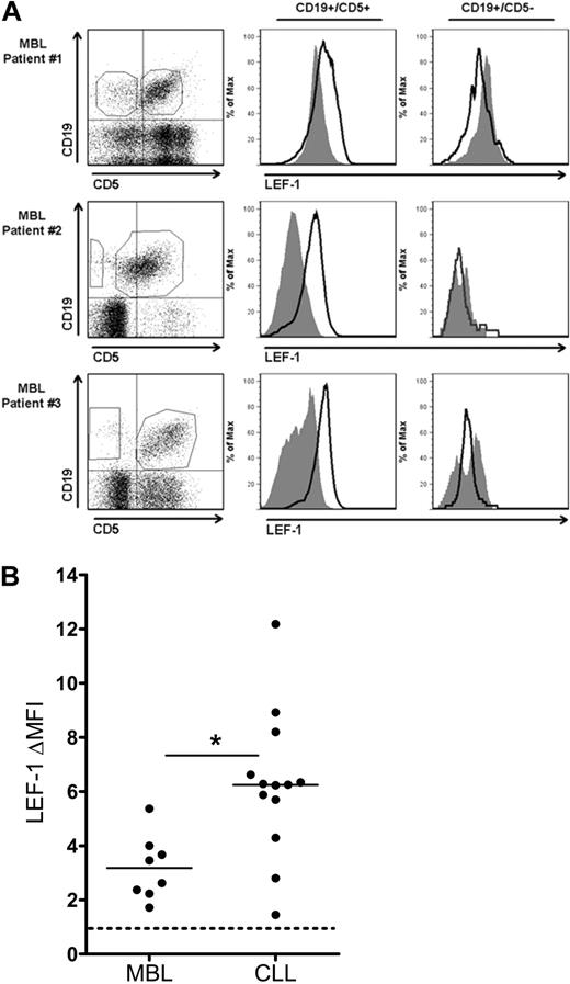 Figure 5. CD19+/CD5+ cells of the CLL precursor state MBL express LEF-1. (A) Three representative flow cytometric analyses of peripheral blood mononuclear cells from MBL patients stained with anti-CD19, CD5, and LEF-1 antibodies. Isotype control histogram is shaded gray; LEF-1 histogram is black. Data are representative of results obtained with 8 MBL patients. (B) The change in mean fluorescence intensity (ΔMFI) between isotype and anti–LEF-1 staining in 8 MBL and 13 CLL samples. *P = .002. Horizontal lines indicate the mean of the group.