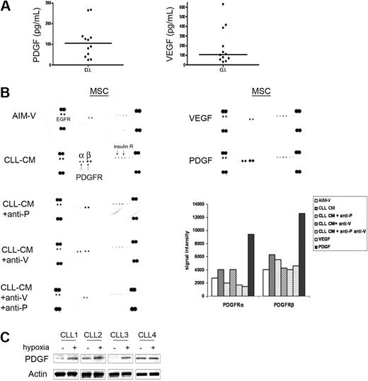 Figure 3. PDGF but not VEGF in the CLL-CM is able to activate MSC PDGFR. (A) Variable levels of PDGF and VEGF were detected in CLL-CM. The line in each dot plot represents the mean level of detected growth factor. (B) RTK array analysis of CLL MSC stimulated by CLL-CM for 30 minutes in the presence or absence of neutralizing antibody to PDGF, VEGF, or both. RTK array analysis of CLL MSC was performed in the presence of either PDGF-AB or VEGF-A ligand. (C) Immunoblot analysis demonstrating the presence of PDGF-AB in CLL B cells. PDGF-AB was up-regulated when CLL B cells were cultured under hypoxic conditions after overnight culture in 3 of 4 patients tested. CLL 1-4, 4 CLL patient lysates used in the immunoblot. Four different CLL samples were run on separate gels and are shown. Each gel is shown in separate rectangle.