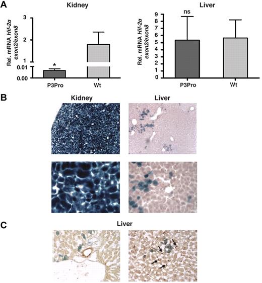 Figure 1. Hif-2α deletion in the kidney occurs with high efficiency. (A) Shown is the mean mRNA expression level of Hif-2α exon 2 in kidney and liver extracts by real-time PCR analysis (n = 6). Exon 2 is flanked by loxP site and targeted for Cre-mediated recombination. Exon 2 expression levels were normalized to Hif-2α exon 8, which is not deleted. Bars represent mean values ± SEMs. (B) LacZ staining of kidney and liver tissue from a P3Pro mouse expressing the ROSA26R Cre-reporter transgene. Magnification, ×100 (top) and ×400 (bottom). (C) P3Pro-Cre is not expressed in biliary epithelial or Ito cells. Immunohistochemistry was performed in conjunction with X-gal staining on frozen liver tissue sections. LacZ expression did not colocalize with cytokeratin 19 (CK19), which is specific for biliary epithelial cells (left) nor did it overlap with staining for desmin, which is a histologic marker of Ito cells (right). Shown are LacZ-positive cells (blue) and CK19- or desmin-positive cells (brown) on the left or right, respectively. Wt refers to Cre-negative littermates. Arrows depict desmin-positive cells. Magnification, ×400. *P < .05; ns, not statistically significant.