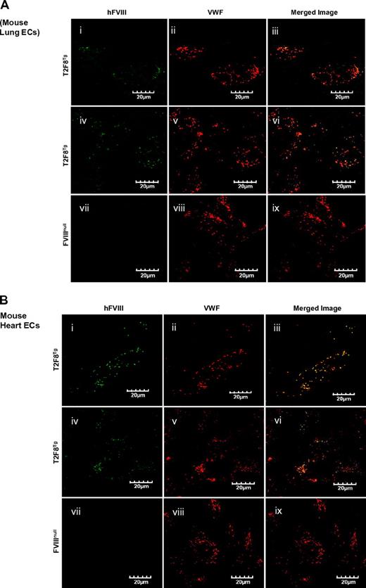 Figure 2. Immunostaining of hFVIII. Localization of transgene protein expression was determined by immunofluorescent confocal microscopy. Endothelial cells were isolated from lung (A) and heart (B) of neonatal mice by immunoselection using Dynabeads M-450 sheep anti-rat IgG beads coated with purified rat anti-mouse CD31 (PECAM-1) antibody. Cells were cultured in vitro for 4 days and then immunostained for either hFVIII using Conan-Alexa 488 or mouse VWF using Dako-Alexa 568. Transgene protein hFVIII was detected in endothelial cells from both lung (Ai-vi) and heart (Bi-vi) of T2F8Tg mice and was colocalized with mouse VWF in Weibel-Parade bodies as shown in yellow in merge images (iii, vi, xi, and xv). No hFVIII was detected in the endothelial cells from FVIIInull mice (Avii-ix,Bvii-x) These results demonstrate that targeting FVIII expression to endothelial cells results in FVIII storage together with VWF in endothelial cell WPB.