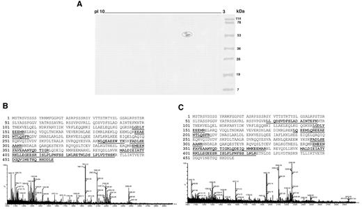 Figure 1. Identification of vimentin as an endothelial protein cofactor in SN-APS patients. (A) Endothelial cell-surface membrane proteins separated by 2DE were transferred onto nitrocellulose membrane and analyzed by immunoblotting with serum from 2 APS-seronegative patients. Two spots, with a molecular weights of 54 and 57 kDa, strongly reactive with serum IgG were identified (circled). (B, C) The 2 spots identified were excised from 2DE gel, digested with trypsin, and then analyzed by MALDI time-of-flight mass spectrometry. MS/MS spectra of trypting peptides matching 2 isoforms of vimentin. x-axis, m/z; y-axis, relative ion intensity. The matched amino acid sequences are bold underlined.