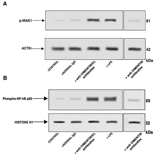 Figure 4. Affinity-purified antivimentin/cardiolipin antibodies from SN-APS induce IRAK1 phosphorylation and activate NF-κB. Endothelial cells were stimulated with affinity-purified antivimentin/cardiolipin antibodies (200 μg/mL), NHS-IgG fraction (200 μg/mL), LPS (100 ng/mL), and affinity-purified antivimentin antibodies (200 μg/mL) for 45 minutes at 37°C, in 5% CO2 and cellular extracts were obtained. (A) Phosphorylated levels of IRAK1 (p-IRAK1) were analyzed in whole-cell extracts by Western blotting with antiphospho-IRAK1 antibodies; for control, the blotted membranes were stripped and reprobed with antiactin antibodies. Bound antibodies were visualized with horseradish peroxidase-conjugated IgG and immunoreactivity was assessed by ECL. One example representative of the patients with antivimentin/cardiolipin antibodies. (B) NF-κB activation was analyzed in nuclear cell extracts by Western blot with antiphospho–NF-κB p65 Ser antibodies; for a control, the blotted membranes were stripped and reprobed with anti–histone H1 antibodies. Bound antibodies were visualized with horseradish peroxidase-conjugated IgG, and immunoreactivity was assessed by ECL. One example representative of the patients with antivimentin/cardiolipin antibodies is shown.