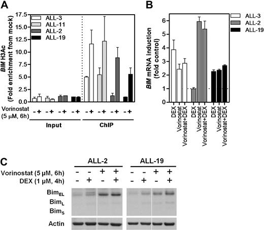 Figure 4. Modulation of BIM acetylation and reexpression with vorinostat in vitro. (A) Two representative sensitive (ALL-3 and-11) and resistant (ALL-2 and -19) xenografts were treated with vorinostat (5μM, 6 hours) in vitro and subjected to H3AcK9 ChIP analysis. (B) BIM mRNA expression was determined by RT2-PCR after treatment with vorinostat (5μM, 6 hours), dexamethasone (1μM, 4 hours), or both in combination and expressed as a fold of untreated controls relative to EF-1α internal control. (C) Protein expression of Bim after treatment with vorinostat (5μM, 6 hours), dexamethasone (1μM, 4 hours), or both in combination was evaluated by immunoblot analysis and expressed relative to Actin in 2 dexamethasone-resistant xenografts (ALL-2 and ALL-19). Splicing within a representative gel is indicated by dividing spaces.