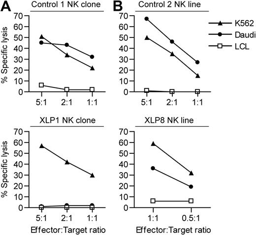 Figure 2. XLP NK cell cytotoxicity against NK-sensitive target cell lines. The NK-sensitive cell lines K562 and Daudi or as a control an LCL were used as targets in chromium release cytotoxicity assays with: (A) NK clones derived from a healthy donor (top panel) or XLP1 (bottom panel) or (B) NK lines established from a healthy donor (top panel) or XLP8 (bottom panel). Results are expressed as the percentage of chromium release from the target cells at the different effector:target ratios.