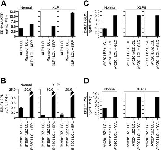 Figure 3. Recognition of LCLs by EBV-specific CD8+ T-cell clones from XLP patients or healthy carriers. ELISA assays were used to estimate IFN-γ secretion from CD8+ T-cell clones incubated overnight with the different target LCLs. (A) IFN-γ secretion by KRP-specific T-cells from a healthy carrier (left panel) or 2 independently derived clones from XLP1 that had been incubated with either XLP1's LCL, an HLA mismatched LCL, or KRP-peptide sensitized XLP1 LCL. (B) IFN-γ secretion by EPL-specific T cells from a healthy carrier (left panel) or 2 independently derived clones from XLP1 that had been incubated with either an HLA B35 matched LCL (BZ+ LCL), an HLA B35 matched BZLF1 knock out EBV lytic antigen–negative LCL (ΔBZ LCL), or HLA B35 matched EPL peptide–sensitized LCL. IFN-γ secretion by (C) GLC-specific T cells and (D) YVL-specific T cells from a healthy carrier (left panels) or 2 independently derived clones from XLP8 that had been incubated with either an HLA A2 matched LCL (BZ+ LCL), an HLA A2–matched BZLF1 knockout EBV lytic antigen–negative LCL (ΔBZ LCL), or an HLA–A2 matched LCL sensitized with the appropriate peptide.