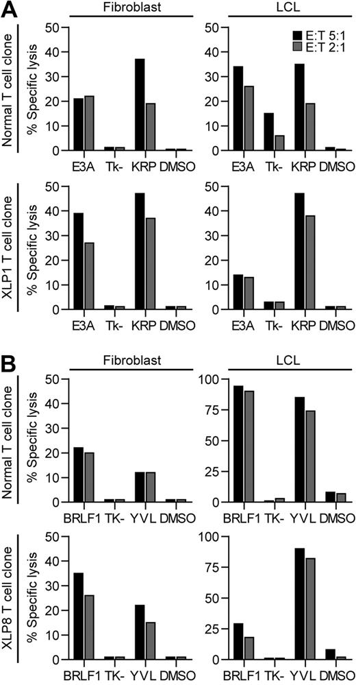 Figure 4. Recognition of EBV antigen expressing fibroblast or LCL targets in cytotoxicity assays by EBV-specific CD8+ T cells derived from healthy controls or XLP patients. (A) HLA-B*2705 fibroblasts (left panels) or LCLs (right panels) were infected with either vaccinia virus expressing EBNA3A or a control vaccinia Tk- construct, or were sensitized with cognate KRP-peptide or DMSO and assayed for recognition by healthy donor–derived KRP-specific clones (top panels) or XLP1 KRP-specific clones (bottom panels). (B) HLA-A*0201 fibroblasts (left panels) or LCLs (right panels) were infected with vaccinia virus expressing either BRLF1 or the control vaccinia Tk- construct, or were sensitized with cognate YVL-peptide or DMSO and assayed for recognition by healthy donor–derived YVL-specific clones (top panels) or XLP8-derived YVL-specific clones (bottom panels). Clones were incubated at the indicated effector:target ratios in 5-hour assays. The standard deviation for the replicates were all within 10% of the value measured.