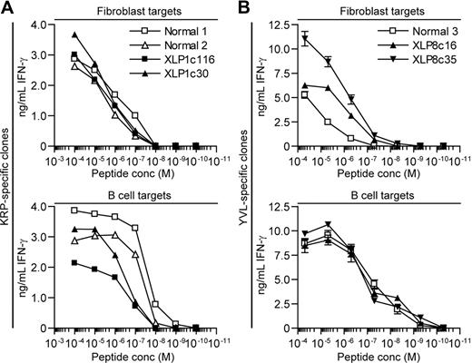 Figure 5. Sensitivity of XLP and healthy donor derived CD8+ T-cell clones assayed against peptide sensitized fibroblasts and B-cell targets. (A) HLA-B*2705 fibroblasts (top panel) or B-cell blasts (bottom panel) were sensitized with 10-fold dilutions of KRP-peptide, incubated overnight with KRP-specific T-cell clones derived from XLP1 or healthy donors and recognition assessed by measuring IFN-γ secreted by the T cells. (B) HLA-A*0201 fibroblasts (top panel) or LCLs (bottom panel) were sensitized with 10-fold dilutions of YVL-peptide, incubated overnight with YVL-specific T-cell clones derived from XLP8 or healthy donors, and recognition assessed by measuring IFN-γ secreted by the T cells.