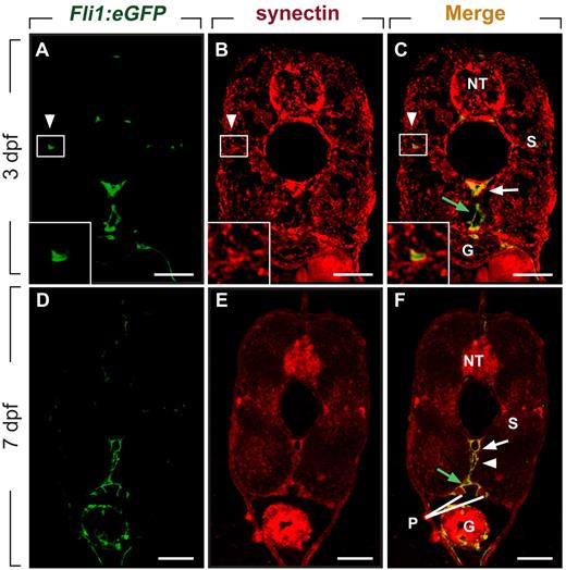 Figure 1. Synectin is expressed in lymphatic vessels in zebrafish embryos. Scale bars represent 10 μm in panels A-F. In all panels, the dorsal side of the embryo is at the top of the figure. G indicates gut; NT, neural tube; P, pronephric duct; and S, somite. (A-C) Transverse sections through the trunk of a 3-dpf wild-type Fli1:eGFPy1 zebrafish embryo, stained by immunohistochemistry using a polyclonal anti–human synectin antibody, and by DAPI nuclear stain, revealing prominent synectin expression in the NT, G, S, dorsal aorta (DA, white arrow), posterior cardinal vein (PCV, green arrow) and parachordal lymphangioblast (PL) cells (white arrowhead). Insets show magnification of the boxed areas (PL cells) in each panel. (D-F) Using the same staining procedure on transverse sections through the rostral trunk of a 7 dpf wild-type Fli1:eGFPy1 zebrafish embryo, similar widespread synectin expression in the NT, G, S, P, DA (white arrow), PCV (green arrow), and thoracic duct (white arrowhead) was observed.