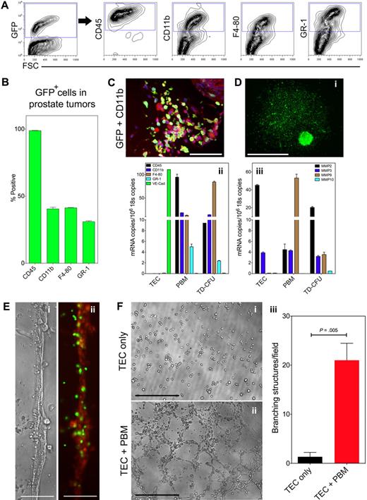 Figure 2. In vivo and in vitro characterization of bone marrow–derived cells in TRAMP prostate tumors. (A) FACS analysis of spontaneous prostate tumors in TRAMP mice (24-30 weeks of age). Representative plots of GFP+ cells retrieved from tumors costained with the indicated antibodies is shown. (B) Quantitative analysis of hematopoietic/myeloid cells in TRAMP prostate tumors (n = 3). Approximately 99% of all BMDC are CD45+ hematopoietic cells. (C) Sections of well-differentiated prostate tumors were stained with GFP and CD11b antibodies (i). Yellow cells indicate the merged coexpression. Nuclei were counterstained with DAPI (blue). Scale bar represents 100 μm. (D) After bone marrow ablation/engraftment, collagenase-digested prostate tumors were plated into tissue-culture dishes. Numerous GFP+ colonies appeared after approximately 1 week in culture from which spindle-shaped GFP+ cells emerged (i). Scale bar represents 0.5 mm. After 2 weeks, cells were treated with trypsin, and tightly adhered, trypsin-resistant cells TD-CFUs were analyzed by qRT-PCR. Similar to PBM cells, TD-CFUs were enriched in expression of CD45, CD11b, F4-80, and GR-1 but not VE-Cadherin (ii). Also by qRT-PCR, MMP2 is predominately expressed by TECs, while PBM cells and TD-CFUs express both MMP9 and MMP2 (iii). (E) TECs formed branching, cord-like structures when plated at low densities and admixed with freshly isolated PBM cells on thin matrigel layers. PBM cells, which appear as small, refractive cells in the high-powered magnification, closely aligned with these branching structures along the TEC surface (i). At right, the same field is shown where TECs fluoresce in red and PBM cells from GFP+ donor mice fluoresce in green (ii). Scale bars represent 50 μm. (F) PBM cells addition increased TEC branching when cells were plated in low serum and at low density on matrigel. The addition of TECs only resulted in few branching structures (i) while TECs cocultured with PBM cells resulted in TEC branching and tube formation (ii). PBM cells addition increased TEC branching 10-fold when averaged from 3 independent observations (iii). Data were evaluated by Student t test and the P value is indicated on the graph. Scale bars represent 0.5 mm.