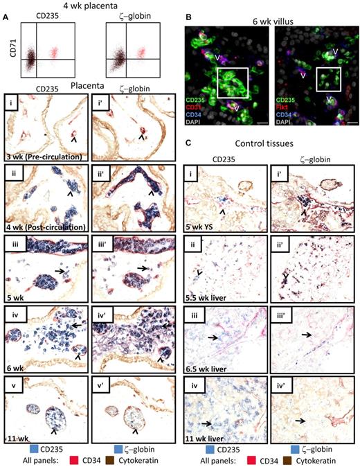 Figure 2. RBCs in the placental villous stroma are of the primitive erythroid lineage. (A) Intracellular flow cytometry confirmed that the CD235+CD71+ erythroid cells in the early first trimester placenta were ζ-globin expressing primitive RBCs (colored cells are the same in both FACS plots). IHC of adjacent tissue sections demonstrated that the RBCs observed in the placental villous stroma were of the primitive lineage. In precirculation placentas (i-i′), no ζ-globin+CD235+ cells were found in placental blood vessels (arrowheads). The first cells in the vasculature (arrowheads) were CD235+ (II) and ζ-globin+ (ii′). At 5 weeks of age, all RBCs in the placenta expressed ζ-globin (iii vs iii′) and some were localized to the placental stroma (arrows). By 6 weeks many more primitive RBCs were observed in the villous stroma (arrows in iv-iv′). At 11 weeks, the placental RBC pool comprised mostly ζ-globin− RBCs that were contained in blood vessels (arrowheads in v-v′). Images were acquired at 400× original magnification. (B) Immunofluorescence using 3 different endothelial markers, CD31, Flk1, and CD34, confirmed the extravascular localization of placental RBCs (white boxes). V indicates blood vessels; scale bars, 20 μm. (C) Staining of yolk sac and fetal liver at the developmental stages when RBC extravasation was prominent in the placenta did not reveal major populations of ζ-globin+ extravascular primitive RBCs (i-iii). By 11 weeks, the liver had generated ζ-globin− definitive RBCs (iv-iv′). Arrowheads mark circulating RBCs; arrows mark RBCs in the fetal liver parenchyma. Images were acquired at 200× original magnification.