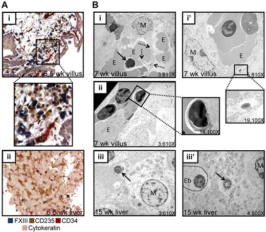 Figure 4. Primitive RBCs enucleate in the placental stroma in close association with placental macrophages. (A) Immunohistochemical staining of 6.5-week placental sections for macrophages (FXIII, blue), RBCs (CD235, brown), endothelial cells (CD34, red), and trophoblast (cytokeratin, purple) demonstrated the congregation of macrophages and RBCs in the extravascular stroma in placental villi (i; a higher magnification inset of the boxed area is also shown), whereas at the same developmental age very few macrophages were found in the fetal liver (ii). Images were acquired at 200× original magnification. (B) EM performed on 7-week placental villi demonstrated both direct physical interactions between placental macrophages and erythroblasts (i). Dashed arrows indicate macrophage cytoplasmic projection, solid arrow denotes ejected nucleus; M, macrophage; E, erythroid cell. as well as macrophages containing ingested nuclei (i′ inset) and pyrenocytes in circulation (ii inset). These macrophage-RBC associations were reminiscent of RBC maturation during definitive erythropoiesis in the fetal liver, where both free pyrenocytes (iii arrow) and engulfed nuclei (iii′ arrow; Eb, erythroblast) were present. All original magnifications for EM micrographs are as indicated.