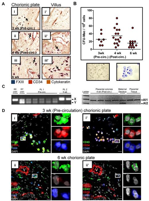 Figure 5. The human placenta contains macrophage progenitors before the onset of fetoplacental circulation. (A) IHC of placental sections revealed the progressive migration of FXIII+ macrophages (arrows) from the chorionic plate (i) into the villi (ii′-iii′). Images were acquired at 200× original magnification. (B) Methylcellulose colony- forming assays documented the presence of clonogenic macrophage progenitors in the chorionic plate of the human placenta before the onset of fetoplacental circulation. A representative macrophage colony (original magnification, ×100) and May-Grunwald Giemsa–stained cytospin of a macrophage colony (original magnification, ×400) are shown. (C) PCR performed on single colonies from methylcellulose for the Y chromosome was able to demonstrate the fetal origin of placental colonies from male (sample 1, XY) but not female (sample 2, XX) specimens. In the case of an XX specimen, informative microsatellites, defined by differences in the number of repeats contained in alleles (Al1 and Al2) inherited from each parent could be used to verify the fetal origin of placental progenitors. Of 176 colonies picked and analyzed (ranging from precirculation to 8 weeks developmental age), none was found to be maternal (data not shown). (D) Immunofluorescent staining of placental sections demonstrated the presence of macrophage-committed progenitors (CD34+CD43+FXIII+ and CD34+CD43+CD68+ cells; i and i′ insets, respectively) in the chorionic plate of precirculation specimens. Later in development, placental macrophages no longer expressed CD34. V indicates blood vessels; scale bars, 20 μm.