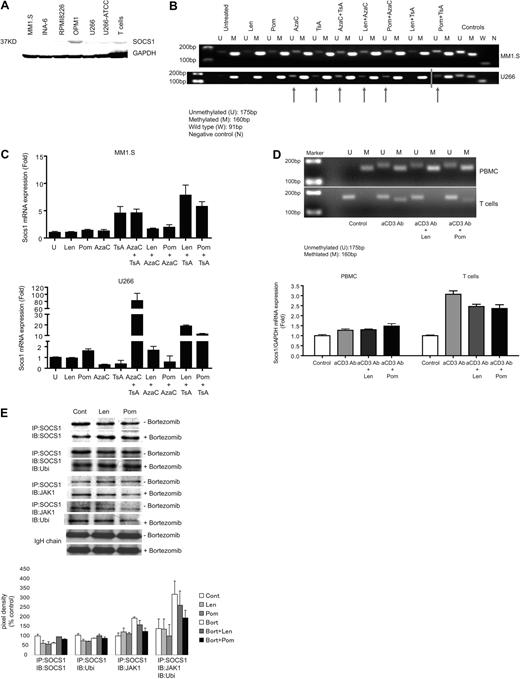 Figure 4. IMiDs epigenetically regulate SOCS1 methylation in MM cells in vitro. (A) Baseline SOCS1 protein expression in MM cell lines and unstimulated CD3+ T cells is shown by Western blot. Glyceraldehyde 3-phosphate dehydrogenase (GAPDH) expression was determined as an internal control for loading. Data are demonstrated as a representative of 3 separate experiments. (B) Methylation analysis of SOCS1 in MM cell lines MM1.S and U266 is assessed by MSP. MM1.S and U266 cells were incubated either alone or in combination with IMiDs (lenalidomide and pomalidomide; 1μM), 5-Azacytidine (5-AzaC; 0.5μM), and Trichostatin A (TsA; 0.1μM); sodium bisulfite–modified genomic DNA was then subjected to MSP using MSP primers that specifically recognize unmethylated or methylated SOCS1 gene sequences. U indicates the presence of unmethylated SOCS1 gene (175 bp); and M indicates the presence of methylated SOCS1 gene (160 bp). In vitro unmethylated and methylated DNA were used as controls for methylation. W indicates wild-type SOCS1 and N indicates water as control for PCR (blue line indicates the merged photomicrograps run on the same gel but in 2 lanes). (C) SOCS1 gene transcriptional expression is shown by quantitative real-time PCR in MM1.S and U266 cells. Cells were incubated either alone or in combination with IMiDs (1μM), 5-AzaC (0.5μM), and TsA (0.1μM); SOCS1 gene expression was then analyzed by real time, quantitative PCR using SYBR-Green labeling. Data are demonstrated as the mean fold increase relative to baseline levels (untreated cells). All quantitative RT-PCR data are normalized to expression level of GAPDH mRNA. (D) Methylation analysis of SOCS1 in PBMCs and T cells from healthy donors by MSP. After bisulfite modification, genomic DNA of PBMCs and T cells purified from the same PBMCs was subjected to SOCS1-specific MSP (top panel). U indicates unmethylated (175 bp) and M indicates methylated (160 bp) SOCS1 gene. Bottom panel shows expression of SOCS1 mRNA measured by quantitative RT-PCR in PBMCs and T cells from the same healthy donor. Data are demonstrated as the mean fold increase relative to baseline levels (untreated cells). All quantitative RT-PCR data are normalized to expression level of GAPDH mRNA. One representative of 3 independent experiments is shown. (E) Coimmunoprecipitation analysis of SOCS1 mediated JAK1 ubiquitination is shown in CD3T cells incubated in the absence or presence of lenalidomide and pomalidomide after preincubation with or without bortezomib. Cells were stimulated with IFNγ for 15 minutes to induce SOCS1 expression. SOCS1 protein was immunoprecipitated and blotted with anti-SOCS1 moAb, anti-JAK1 Ab, and ubiquitin moAb. Top panel demonstrates IP:IB bands. Bottom panel demonstrates pixel density values of each band expression relative to IgH chain expression. Fold expression of proteins are determined relative to control. One representative of 3 independent experiments is shown.