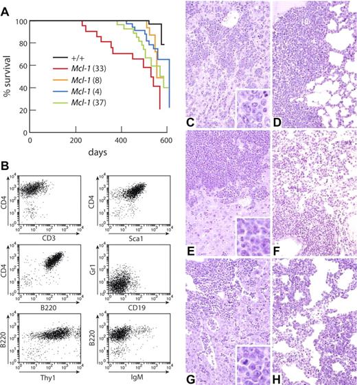 Figure 4. VavP-Mcl-1 mice die of lymphoma. (A) Kaplan-Meier survival curve of tumor-related deaths in cohorts of the following mice: WT (black, n = 54); Mcl-1(33) (red, n = 23), median survival, 531 days; Mcl-1(8) (green, n = 29), median survival, 571 days; Mcl-1(37) (orange, n = 18), median survival, 556 days; and Mcl-1(4) (blue, n = 38), median survival, 612 days. (B) Immunophenotype of representative stem/progenitor cell tumor (from transgenic mouse Mcl-1(33) #90). (C-D) Representative histology from VavP-Mcl-1 mouse dying of primitive/progenitor cell tumor showing infiltration of (C) liver and (D) lung. (E-F) Representative histology from VavP-Mcl-1 mouse dying of pre-B cell tumor showing infiltration of (E) liver and (F) lung. (G-H) Representative histology from VavP-Mcl-1/Eμ-Myc mouse dying of B-cell tumor showing infiltration of (G) liver and (H) lung. Sections were stained with hematoxylin and eosin. Original magnification ×20 in main panels. Sections were photographed on Kodak Ektachrome 64T film using a Zeiss Axiophot microscope and camera with a Zeiss 20×/0.60 NA objective lens. The scanned images were processed using Adobe Photoshop software.