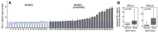 Figure 4. PD-1 ligand amplification and overexpression in primary MLBCL. (A) qPCR-based DNA copy number analysis of PD-L1 in 41 primary MLBCLs. (B) RT-qPCR analysis of PD-L1 and PD-L2 transcript abundance in the same series of primary MLBCLs. Transcript abundance in tumors with normal or increased 9p24.1 is represented in box blots.