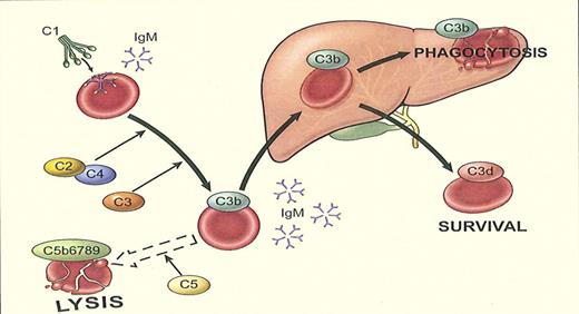 Cooling of the blood during passage through peripheral vessels allows immunoglobulin M (IgM) cold agglutinin to bind to erythrocytes, causing agglutination and complement protein 1 (C1) fixation. C1 esterase activates C4 and C2, generating C3 convertase, which binds and splits C3, leading to deposition of C3b on the cell surface. During return to the central circulation and subsequent warming, IgM removes into serum and the agglutinated cells are detached from each other. C3b remains bound and could activate C5, leading to the formation of the membrane attack complex and intravascular hemolysis, which seems to play a role during acute exacerbations. In steady state, however, phagocytosis of C3b-coated erythrocytes by reticulo-endothelial cells in the liver is the predominant pathway, resulting in extravascular hemolysis. Intrahepatic C3b conversion leads to deposition of C3d on the surviving erythrocytes, which are released into circulation.8 (Image from Clinical Lymphoma & Myeloma, reprinted with permission.)
