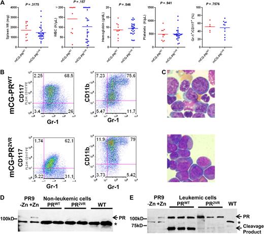 Figure 5. Analysis of APL arising from mCG-PR2VR mice. (A) Analysis of leukemic mCG-PRWT (n = 11) and mCG-PR2VR (n = 29) mice for spleen weights, complete blood counts, and immunophenotyping by flow cytometry for Gr-1+/CD117+ blasts. (B) Immunophenotyping and (C) Wright-Giemsa staining of spleen cells from representative leukemic mCG-PRWT and mCG-PR2VR mice. (D-E) Western blotting of cell lysates from (D) bone marrow of preleukemic mice (E) spleen from leukemic mice. * represents a nonspecific band observed in the bone marrow extracts. Controls are a U937-PR9 cell line that contains the PR cDNA under the control of a Zinc (Zn2+) inducible promoter treated with 100μM ZnSO4 for 1 hour.