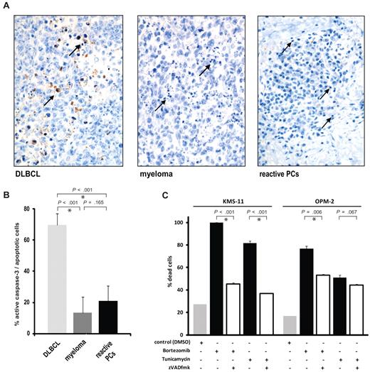 Figure 3. The majority of human short-lived plasma cells undergo apoptosis without activation of caspase-3. (A-B) Immunohistochemical analysis of human lymph nodes infiltrated by diffuse large B cell lymphoma (DLBCL, n = 8), myeloma (n = 7), and reactive plasmacytosis (n = 8) using an antibody that reacts specifically with active caspase-3. The bar chart shows mean percentages and SEM of apoptotic cells staining positive for active caspase-3 relative to total apoptotic cells. Asterisks indicate statistical significance. Sample tissue sections show active caspase-3 (brown staining), and arrows indicate examples of apoptotic cells with typical condensed and/or fragmented nuclei. (C) Caspase-dependent and -independent cell death in response to apoptotic stimuli in human myeloma cell lines. The myeloma lines KMS-11 and OPM-2 were treated with bortezomib (20nM), tunicamycin (5 μg/mL), and zVADfmk (100μM) for 48 hours as indicated, and cell death was assessed by staining with annexinV-FITC and propidium iodide (mean and SEM of 2 independent experiments).