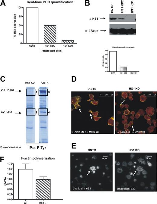 Figure 1. HS1 silencing affects F-actin polymerization, distribution, and activation of cytoskeleton components. (A) Relative expression of HS1 evaluated by real-time PCR in 3 stable cell lines obtained from MEC1 cell line, either expressing GFP only (CNTR) or after HS1 silencing (HS1 KD1 and KD2). (B) Western blot analysis for HS1 on silenced cell lines (CNTR, KD1, and KD2); β-actin is used as control. Graph represents the densitometric analysis to quantify the protein expression levels. Because the silencing was more effective in HS1 KD1 cells in further experiments, we used only this cell line that is from now on defined as HS1 KD. (C) Immunoprecipitation experiments for total phosphotyrosine on CNTR and HS1 KD cell protein lysates; the gel is blue-Coomassie stained, and bands 1, 2, 3, and 4 were trypsin digested and analyzed by high-resolution mass spectrometry (see “Results” and Table 1). (D) Confocal analysis of CNTR and HS1 KD cells with anti-actin and anti–myosin heavy chain 9 (MYH9) primary antibodies detected with Alexa Fluor 546 (yellow)– and 633 (red)–conjugated secondary antibodies. White arrows indicate characteristic CNTR cell protrusions and HS1 KD dotted actin accumulation, the overlap between Alexa Fluor 546 and 633 is orange. Images were acquired with a laser scanning confocal microscope (Leica SPS) with the use of an inverted 63× oil objective equipped with a resonant scanner. (E) Total internal reflection fluorescence acquisition after Phalloidin Alexa Fluor 633 staining on CNTR cells and HS1 KD adhered on poli-L-Ornithine coating, arrows indicate the different F-actin distribution. Images were acquired with a TIRF microscope (Leica AM) with the use of a 60× oil objective equipped with an Andor ENCCD camera. (F) F-actin polymerization is represented as the ratio of the flow cytometric mean fluorescence intensity (MFI) values after and before IgM stimulation in WT and HS1−/− mice B splenocytes (6 animals/group).