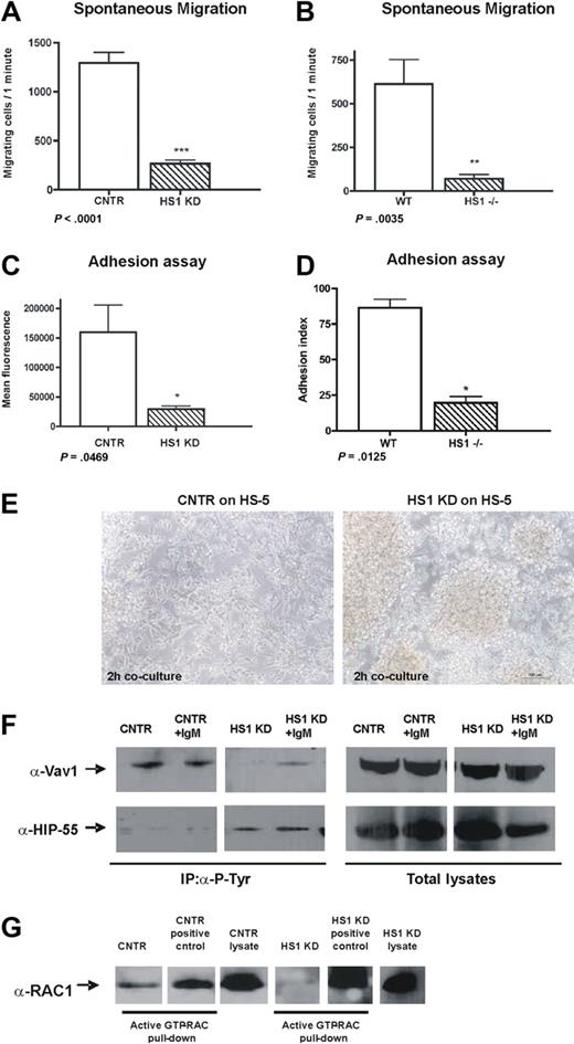 Figure 2. HS1 absence affects migration, adhesion, and homotypic aggregation. (A) Spontaneous migration after 4 hours on transwell (pore size 5.0 μm) of CNTR and HS1 KD cell and (B) WT and HS1−/− mice purified B splenocytes (6 animals/group) is shown (*P ≤ .05; **P ≤ .01; ***P < .001). (C) Adhesion was quantified as mean fluorescence intensity (MFI) values for CNTR and HS1 KD cells and (D) as adhesion index for WT and HS1−/− mice B cells (*P ≤ .05; **P ≤ .01; ***P < .001). (E) CNTR and HS1 KD cells adhesion on a HS-5 stroma cell layer after 2 hours of coculture was acquired with Nikon TS100 microscope with the use of a 10× dry objective. (F) Immunoprecipitation experiments with the use of anti–P-Tyr on CNTR and HS1 KD cells before and after anti-IgM stimulation and WB analysis for Vav1 (top) and HIP-55 (bottom). Total lysates are shown as control. (G) Rac1/2 activation assay was performed as pull-down on CNTR and HS1 KD cells (positive controls were provided with the kit). Total lysates were also used to detect Rac1/2 expression.
