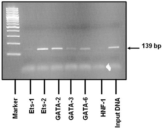 Figure 5. Results of the ChIP assay. Native chromatin derived from BOECs was immunoprecipitated with antibodies against Ets-1, Ets-2, GATA-2, GATA-3 and GATA-6. Binding of the liver-specific transcription factor, HNF-1, known not to bind to this region was also evaluated. PCR was designed to amplify a 139-bp region (−111 to +28; a region containing the deletion mutation). The 2% agarose gel shows that amplified bands match the predicted PCR fragment size in relation to the DNA ladder. The VWF sequence in which the deletion is located binds clearly to Ets-2 and GATA-2. Weaker binding is seen with GATA-3 and GATA-6. Positive (RNA pol II) and negative (mouse IgG) controls produced the expected results (data not shown).