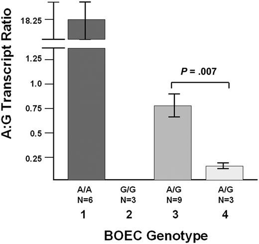 Figure 6. Quantitative RT-PCR studies with BOEC-derived mRNA. Using the SNP c.2365G/A (rs1063856) to differentiate the 2 VWF transcripts, the index case who is heterozygous G/A for this SNP (n = 3 experiments) was studied and compared with 6 healthy control individuals: 2 A/A subjects (lane 1, n = 6 experiments), 1 G/G subject (lane 2, n = 3 experiments), and 3 G/A heterozygotes (lane 3, n = 9 experiments). The graph shows the average A:G transcript ratio (± SEM). In lane 1, The A:G ratio in the A/A homozygotes is not infinite because there is some variable “background” binding of the G probe to the A transcripts. In lane 2, the A:G ratio was always “0,” because there were never any A transcripts detected in the G/G homozygote. In the index case (lane 4, n = 3 experiments), the A:G ratio is 4.6-fold lower that the mean A:G ratio in the 3 normal G/A heterozygous subjects (P = .007). The VWF mutation is in cis with the c.2365A/G (rs1063856) SNP “A” allele, and thus, the promoter deletion is associated with reduced VWF transcript production.