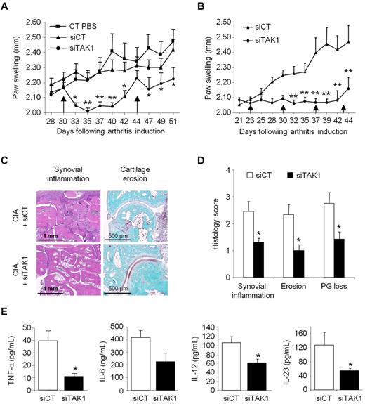Figure 4. Systemic TAK1-siRNA lipoplexes delivery alleviates inflammation in experimental autoimmune arthritis. DBA/1 mice were immunized with bovine type II collagen and boosted on day 21. Mice were intravenously administered (arrows) with 0.5 mg/kg of TAK1 siRNA (siTAK1). Control groups were injected with either PBS or a nontargeting control siRNA sequence (siCT). All siRNA duplexes were formulated with the cationic liposome, RPR209120/DOPE, and a DNA carrier, as described in “siRNA lipoplexes treatment.” (A) Mice with ongoing inflammation were administered with siTAK1 lipoplexes on days 30 and 44, and paw swellings were measured overtime. (B) From arthritis onset (day 23), mice were injected weekly with siCT or siTAK1 lipoplexes at the indicated time points. (C) HE (synovial inflammation; scale bar, 1 mm)–, safranin O/Fast green (cartilage erosion and proteoglycan loss; scale bar, 500 μm)–stained representative ankle-joint sections from experiment shown in B. (D) Histologic scores of synovial inflammation, cartilage erosion, and cartilage proteoglycan (PG) loss from the experiment shown in B. (E) Cytokine levels of TNF-α, IL-6, IL-12, and IL-23 in 24-hour conditioned media from the knee joints of control and TAK1 siRNA-treated mice were measured by ELISA at euthanasia. Results in panel A are the mean ± SEM of 10 mice per group, and results in panels B-E are the mean ± SEM of 7-8 mice per group. * P < .05, ** P < .01.