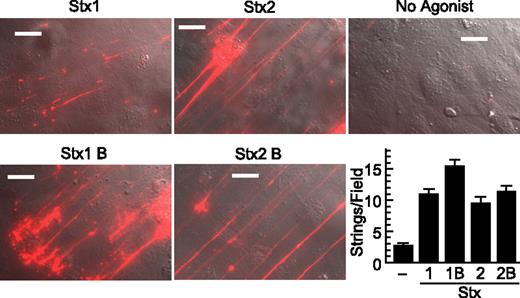 Figure 2. Stx1B and Stx2B induce secretion of VWF strings from cultured HUVECs. human umbilical vein endothelial cells (HUVECs) were perfused in a parallel plate flow chamber at a shear stress of 2.5 dyn/cm2 for 10 minutes with fluorescent anti–von Willebrand Factor (anti-VWF) antibody and the indicated agonist (200 ng/mL). VWF strings were counted in 10 fields and values shown as mean ± SE. Scale bars are 10 μm. Experiments were conducted at least 3 times with similar results.