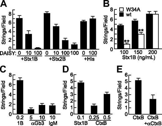 Figure 4. Specificity of StxB- and CtxB-induced VWF secretion. (A) Gb3 analog DAISY (μg/mL) was incubated with Stx1B, Stx2B (200 ng/mL), or histamine (100μM) before perfusion of HUVECs and quantification of VWF strings. (B) Wild-type Stx1B (■) and Stx1B W34A (□) were compared for ability to induce VWF string formation by HUVECs. Indicated comparisons between wild-type (wt) and W34A Stx1B are significant at P < .01 (**) by Student t test. (C) VWF string formation on HUVECs was assessed in response to recombinant Stx1B, anti-Gb3 IgM, or control mouse IgMκ antibody (Sigma-Aldrich); concentrations are in units of micrograms per milliliter. (D) VWF string formation on HUVECs in response Stx1B and CtxB at the indicated concentrations (μg/mL). (E) VWF string formation on HUVECs in response to CtxB (0.5 μg/mL) without or with anti-CtxB antibody (1 μg/mL). Experiments were performed at least 3 times with similar results. Values are shown as mean ± SE.