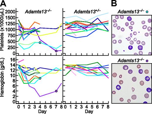Figure 7. Stx2B induces thrombotic microangiopathy in Adamts13−/− mice. Stx2B 1.25 ng/g body weight was injected intravenously into 13 Adamts13−/− mice and 13 Adamts13+/− mice. (A) Platelet counts and hemoglobin levels. (B) Blood films for the indicated mice at 4 days (top, reticulocytes 19%) or 7 days (bottom, reticulocytes > 50%) after injection with Stx2B, demonstrating red cell fragmentation and reticulocytosis.