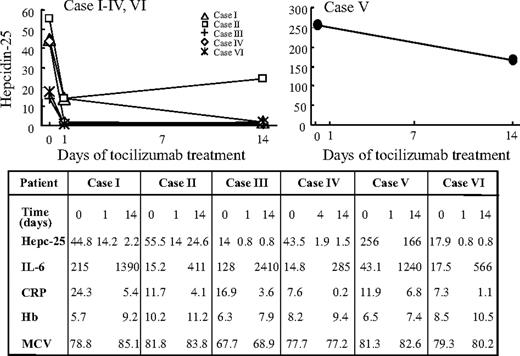 Figure 2. Rapid decrease of serum hepcidin-25 in 6 MCD patients treated with tocilizumab during 14-day short-term course. Administration of tocilizumab resulted in down-regulation of the serum hepcidin level in 6 of 6 MCD cases. (Left panel) In all cases except case V, rapid reduction of serum hepcidin-25 was observed on days 1 or 4 after the initial dose of tocilizumab, followed by reductions in CRP and improvement in Hb levels. (Table) Hb, the serum values of hepcidin-25, CRP, IL-6, and MCV in MCD patients before and after 14 days of therapy with tocilizumab. (Right panel) In case V, the initial hepcidin level was extremely high (256 ng/mL), and it decreased only slightly after tocilizumab administration.