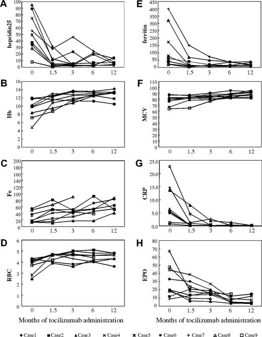 Figure 3. Suppression of hepcidin production accompanied by improvement in inflammatory anemia as well as disease activity in 9 MCD patients treated with anti–IL-6R antibody. Long-term effects were assessed at 1.5, 3, 6, and 12 months after the start of tocilizumab therapy. Serum hepcidin-25 was quantified with a liquid chromatography-tandem mass spectrometry-based assay system. Other serum parameters were measured with standard laboratory techniques. (A) Serum level of hepcidin-25. (B) Hb. (C) Serum iron. (D) RBCs. (E) Ferritin. (F) MCV. (G) CRP. (H) EPO.