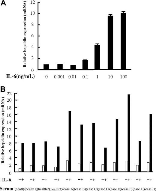 Figure 5. Effect of patient sera on IL-6–induced hepcidin expression in PLC/PRF/5 cells. (A) Dose required for response of hepcidin mRNA expression to IL-6 was determined in PLC/PRF/5 cells grown in medium containing IL-6 at final concentrations of 0.001, 0.01, 0.1, 1, 10, and 100 ng/mL. IL-6 at 0.1 to 10 ng/mL, but not at 0.001 to 0.01 ng/mL, increases the expression of hepcidin in a dose-dependent manner. (B) Hepcidin mRNA expression in PLC/PRF/5 cells treated with culture medium containing 10% of either fetal calf serum, serum from healthy volunteers (n = 3), or serum from MCD patients (n = 8). Cells stimulated with IL-6 (10 ng/mL) showed an approximately 8-fold increase in hepcidin mRNA expression compared with nonstimulated controls. Serum from patients A, B, C, E, F, and H enhanced IL-6–induced hepcidin expression (13- to 22-fold), whereas serum from patients D and G and serum from 3 healthy volunteers had no such effect on IL-6–induced hepcidin expression (6- to 8-fold increase).