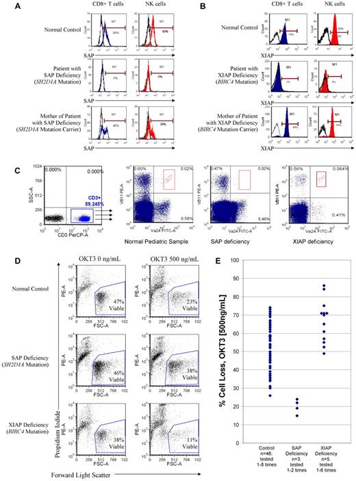 Figure 3. Laboratory studies that can be used to facilitate a diagnosis of XLP. (A) Flow cytometric detection of intracellular SAP in peripheral blood CD8+ T cells and NK cells from a normal control, a patient with SAP deficiency, and a maternal carrier. (B) Flow cytometric detection of intracellular XIAP in peripheral blood CD8+ T cells and NK cells from a normal control, a patient with SAP deficiency, and a maternal carrier. (C) Flow cytometric quantification of peripheral blood NKT cells of a normal control, a patient with SAP deficiency, and a patient with XIAP deficiency (NKT cells identified as CD3+, TCRVα24+, and TCRVβ11 copositive lymphocytes). (D) Sample scatter plots measuring percentage of viable T cells after induction of RICD of activated and expanded T cells of an adult control, a patient with SAP deficiency, and a patient with XIAP deficiency using the anti-CD3 monoclonal antibody OKT3 (500 ng/mL). (E) Graphical representation of T-cell death induced by RICD. Cell death was quantified as follows: % cell loss = (1 − (% viable cells, treated/% viable cells, untreated)) × 100.