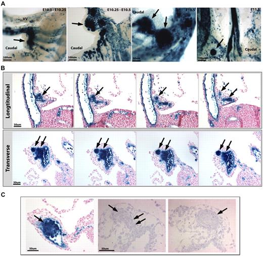 Figure 2. VA cell clusters become extraluminal. (A) VE-cadherin Cre mouse line, crossed to a R26R Cre reporter (β-galactosidase in blue), demonstrates large cell clusters from E10.0 to E10.5 that appear to migrate out of the vessel by E10.75 to E11.0 (arrows) on the caudal side of the artery. By E11.5, smaller clusters are noted on the opposite (cranial) side and proximal to the fetal liver. (B) Serial longitudinal (top) and transverse (bottom) sections through the VA at E10.25 to E10.5 show extravascular budding of the hematopoietic clusters (arrows). (C) The VA produces large clusters of HCs as traced by the VE-cadherin Cre line (β-galactosidase in blue, left panel). Semithin sections (right panels) show clusters of round cells budding from the artery (note the connection of the cluster with the VA; double arrows). A subsequent serial section (to the right) shows a cluster of cells surrounded by an endothelial layer resembling previously described mesenteric blood islands (arrow). (A-C) Scale bars as labeled per row.