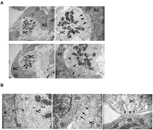 Figure 3. ECs and HCs have cytoplasmic continuity in the VA. (A) Electron microscopy of 2 independent VA clusters at lower (left panels) and higher magnification (right panels) revealed close EC and HC interactions (top and bottom panels). Certain areas of EC-HC contact appear devoid of any cytoplasmic boundaries (arrows). In addition, the HCs are in a proliferative state, as suggested by the condensed chromatin and mitotic appearance of the nuclei (asterisks). (B) Higher magnification demonstrates the loss of boundaries in EC-HC associations of the VA (arrows, left 2 panels). N indicates the nucleus of the EC. We also found cases where intact boundaries were also noted (arrowheads, rightmost panel).