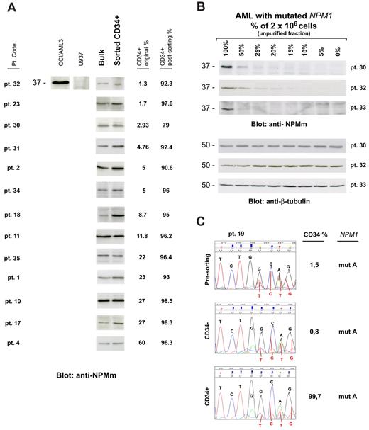 Figure 1. CD34+ cells from AML with mutated NPM1 express mutated NPM1 gene and protein. (A) WB analysis of CD34+ cells isolated from 13 NPM1-mutated AML patient samples. Patient sample codes are indicated on the left (Table 1). Lysates from 1 to 2 × 106 cells of either leukemic bulk (Bulk) or CD34+ MACS sorted (Sorted CD34+) cell population were loaded and run on 10% sodium dodecyl sulfate–polyacrylamide gel electrophoresis gel, transferred to polyvinylidene difluoride membrane, and probed with an anti-NPM mutant (anti-NPMm) rabbit polyclonal antibody. A specific band corresponding to NPM mutant protein is detected at 37-kDa molecular weight (MW) in both bulk and CD34+ cell populations from patients. Columns on the right show percentage of CD34+ cells in the original patient sample and in the CD34-sorted cell population. Lysates from human myeloid leukemic cell lines OCI/AML3 and U937 were used, respectively, as positive and negative control for NPM1 mutant protein expression. (B) AML patient sample dilution test for WB with anti-NPM mutant specific antibody. Unpurified cell fraction from 3 representative NPM1-mutated AML patient samples (patients 30, 32, and 33) was progressively diluted (100%, 50%, 25%, 20%, 15%, 10%, 5%, and 0%) with cells of AML with unmutated NPM1. Lysates from a total of 2 × 106 cells were loaded in each lane and checked for NPM1 mutant protein detection by WB (anti-NPMm, top panels). Progressive dilution of signal indicates that saturation for NPM1 mutant protein detection is not reached in our experimental conditions. Signal is not anymore detectable when NPM1-mutated AML sample is less than 15% to 10% of the original sample. Equal protein lysate loading was demonstrated by blotting the same membranes with an anti–β-tubulin monoclonal antibody (bottom panels). (C) Chromatograms of direct sequencing of the NPM1 gene exon 12 (forward sequence reading) showing both wild-type sequence (coming from the wild-type allele) and TCTG insertion (type A mutation; coming from the mutated allele) in CD34+ cells isolated from bone marrow of 1 patient with NPM1-mutated AML (patient 19; bottom panel) and in the relative controls (leukemic bulk and CD34− cell populations; top and middle panels, respectively). Percentage of CD34+ cells in each sample is shown on the right. Pt. code indicates patient code; and mut A = NPM1 gene mutation A.