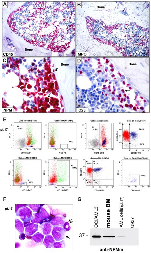 Figure 4. Leukemic engraftment of CD34+ cells from NPM1-mutated AML in immunodeficient mice. (A-D) Bone marrow paraffin sections from a NOG mouse, inoculated (12 weeks before) with 2 × 106 CD34+ cells (purity 98.3%) isolated from 1 patient (patient 17) with NPM1-mutated AML, showing infiltration by human cells, which are positive at immunostaining with a specific anti–human CD45 antibody (A), display a myeloid phenotype (myeloperoxidase, MPO-positive; B) and aberrant cytoplasmic expression of nucleophosmin (NPM; C arrow). Double arrows in panel C indicate a normal osteoblast with nucleus-restricted NPM on the endosteal surface of bone. As expected, nucleolin/C23 was also restricted to the nucleus (D, arrow). (A-D) APAAP; hematoxylin counterstaining. Images were collected using an Olympus B61 microscope and a UPlanApo 20×/0.70 (A-B) and a UPlan FI 100×/1.3 NA oil objective (C-D) Camedia 4040, Dp_soft Version 3.2; and Adobe Photoshop 7.0. (E) Flow cytometric analysis of murine bone marrow confirmed engraftment of human cells (hCD45, 52%) which are prevalently CD33+ (92.7%) and express the monocytic marker CD11b (18.6%). CD34/CD38 staining pattern of engrafted hCD45+ cells is also shown (E right panels). CD34+/CD38− cells (gate on F4) were also CD123+ (E right bottom panel). (F) May-Grünwald-Giemsa staining of a cell cytospin preparation from murine bone marrow of the same case (patient 17) showing large-size leukemic cells with monocytoid appearance (cleaved nucleus, basophilic cytoplasm; arrow) admixed with cells of murine origin (double arrow indicate a normal murine polymorphonucleated cell). (G) WB analysis with anti-NPM mutant specific antibodies (anti-NPMm) of mouse bone marrow cells confirmed expression of NPM1 mutated protein in cells engrafted in mice (lane 2) as well as in the original AML patient sample (lane 3). Positive (OCI/AML3, lane 1) and negative (U937, lane 4) controls are shown.