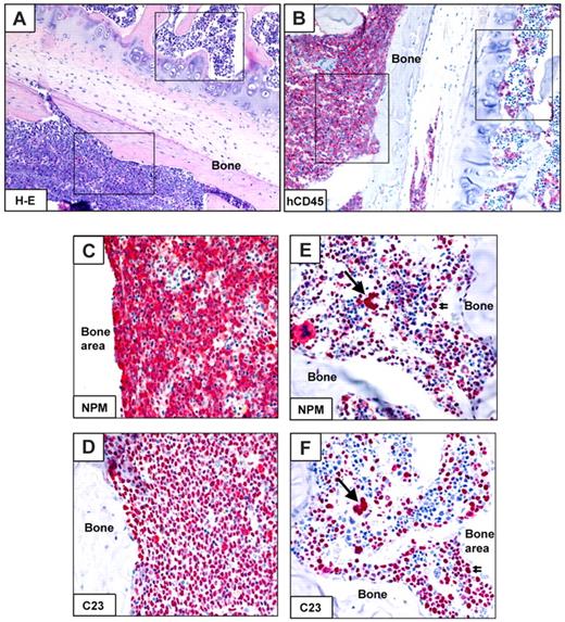 Figure 5. Mixed (normal and leukemic) engraftment of CD34+ cells from NPM1-mutated AML-immunodeficient mice. (A-F) Bone marrow paraffin sections from a vertebral body of an NOG mouse, inoculated (18 weeks before) with 1 × 106 CD34+ cells (purity 79%) from patient 30 (Table 2). An area in the bottom part of panel A (square) is packed with leukemic cells expressing hCD45 (B left square), cytoplasmic NPM1 (C) and nucleus-restricted C23 (D). Another area from the same section shows involvement by normal human hemopoietic cells (square in the top part of panel A), expressing CD45 (B right square), nucleus-restricted NPM1 and C23 (E-F single and double arrows). (A) Hematoxylin-eosin. (B-F) APAAP, hematoxylin counterstaining. Images were collected using an Olympus B61 microscope and a UPlanApo 20×/0.70 (A-B), UPlanApo 40×/0.85 (C-F); Olympus E330-ADU1.2× camera; and Adobe Photoshop 7.0.