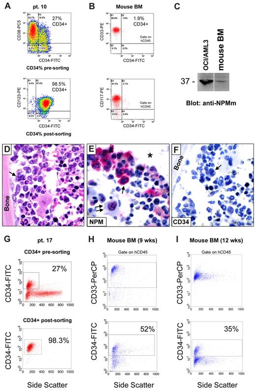 Figure 7. CD34+ cells from NPM1-mutated AML generate CD34− NPMc+ AML in mice. (A-F) Flow cytometry and immunohistochemistry analysis of CD34 antigen expression in leukemia developed in immunodeficient mice (NOD/SCID) inoculated with CD34+ cells (purity 98.5%) isolated from 1 patient (patient 10) with NPM1-mutated AML (27% CD34+ cells in the original sample; A). Flow cytometric analysis of mice bone marrow (BM;16 weeks after the inoculum) showing engraftment of myeloid (CD33+ and CD117+) human cells, which appeared mainly CD34− (1.9% CD34+ cells; B). The leukemic nature of these cells was confirmed by WB with anti-NPM mutant antibody (C), as well as morphologic analysis (D hematoxylin and eosin) and expression of nucleophosmin (NPM) in the cytoplasm of human leukemic cells on bone marrow paraffin sections (E, arrow). As staining control, NPM was characteristically nucleus-restricted in normal murine cells (E, double arrows). The asterisk in (E) indicates an empty space originally filled by bone. CD34 immunostaining was negative in leukemic cells (F arrow). (E-F: APAAP; hematoxylin counterstaining). All images were collected using an Olympus B61 microscope and a UPlan FI 100×/1.3 NA oil objective; Camedia 4040, Dp_soft Version 3.2; and Adobe Photoshop 7.0. A vertical line has been inserted in panel C to indicate a repositioned gel lane. (G-I) Serial flow cytometric evaluation of CD34 antigen expression in human leukemic cells grown in immunodeficient mice (NOD/SCID/IL2Rγnull) killed at 9 (H) and 12 (I) weeks after injection of the same number of CD34+ cells (2 × 106, purity 98.3%) isolated from 1 patient (patient 17) with NPM1-mutated AML (27% CD34+ cells in the original sample; G).